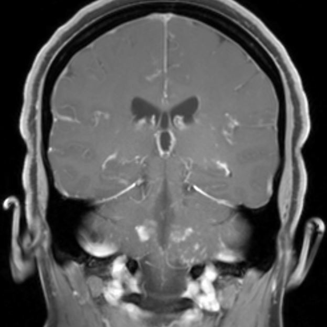 NeuroimagingN's tweet photo. https://t.co/yK1mM400wk