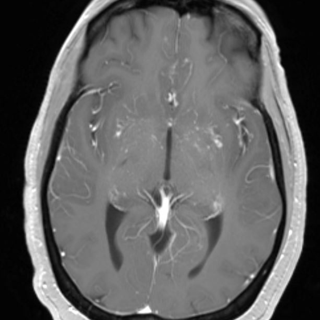 NeuroimagingN's tweet photo. https://t.co/yK1mM400wk