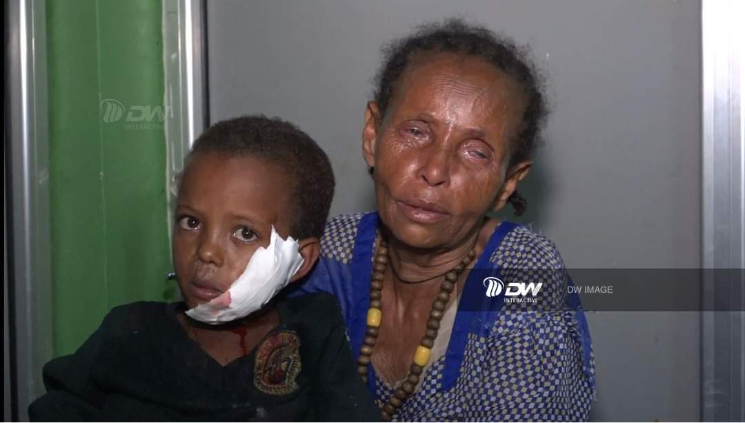 DesiTigray's tweet photo. The Mothers and Children of #Tigray are dying of hunger and lack of medicine
It is known that 600K people died in #725Days
World leaders must watch and listen to Tigray to prevent further loss of life
#Justice4TigrayWomen
@MikeHammerUSA @EUSR_Weber @WFPChief @SpeakerPelosi https://t.co/wxXgwSmqSC