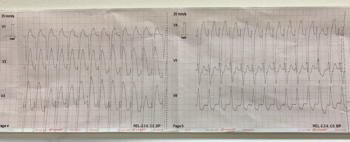 Ecg of the fortnight, goes to Chloe Taylor of hunts stn,
If you can top it, send it to Central MST, you may win a prize 🏆 #ECG  #topten #fortnightprize #canyouguess #canyouwin