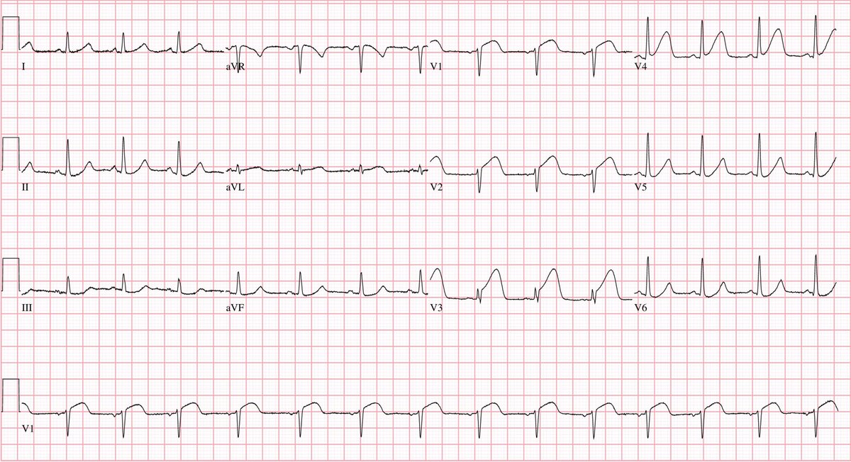 Sam Ghali, M.D. tweet media