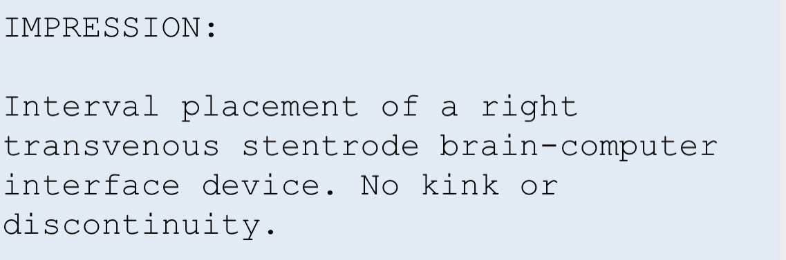 MajidiShahram's tweet image. New phrase has been added to skull X-ray report template here at @MountSinaiNYC New normal! COMMAND Trial #2 Grateful for tremendous effort from @MountSinaiNeuro @MountSinaiRehab @PutrinoLab team #BCI #Synchron #stentrode #brain