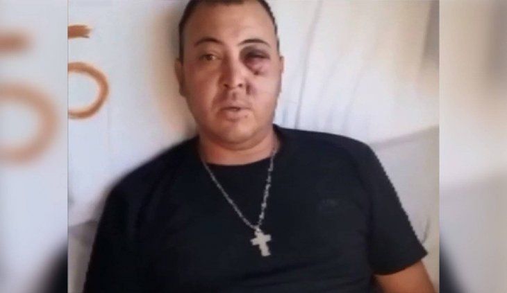 MundoTriperoOK's tweet photo. #CGE #GELP 🔵 RODRIGO ARBALLO: "ME ARRUINARON LA VIDA EN MI PROPIA CASA"

El tripero que perdió un ojo por el impacto de un balazo de goma disparado a quemarropa por la policía Bonaerense durante la feroz represión en el Bosque NECESITA AYUDA.

📲 +info: https://t.co/lJA2KYaeDr https://t.co/0q9OdR8EbP