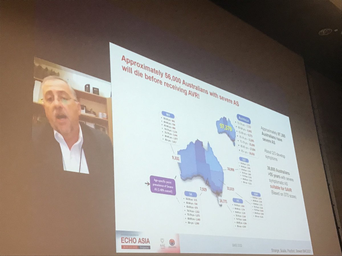 James D Thomas, MD (@jamesdthomasmd1) on Twitter photo <a href="/ScaliaGreg/">Greg Scalia</a> couldn’t make it to Singapore (no chili crab for you!), but he’s still sharing his wisdom on aortic stenosis with us. #echofirst #echoasia <a href="/ASE360/">American Society of Echocardiography</a> <a href="/JaeKOh2/">Jae K. Oh</a> <a href="/ScaliaGreg/">Greg Scalia</a> couldn’t make it to Singapore (no chili crab for you!), but he’s still sharing his wisdom on aortic stenosis with us. #echofirst #echoasia <a href="/ASE360/">American Society of Echocardiography</a> <a href="/JaeKOh2/">Jae K. Oh</a>