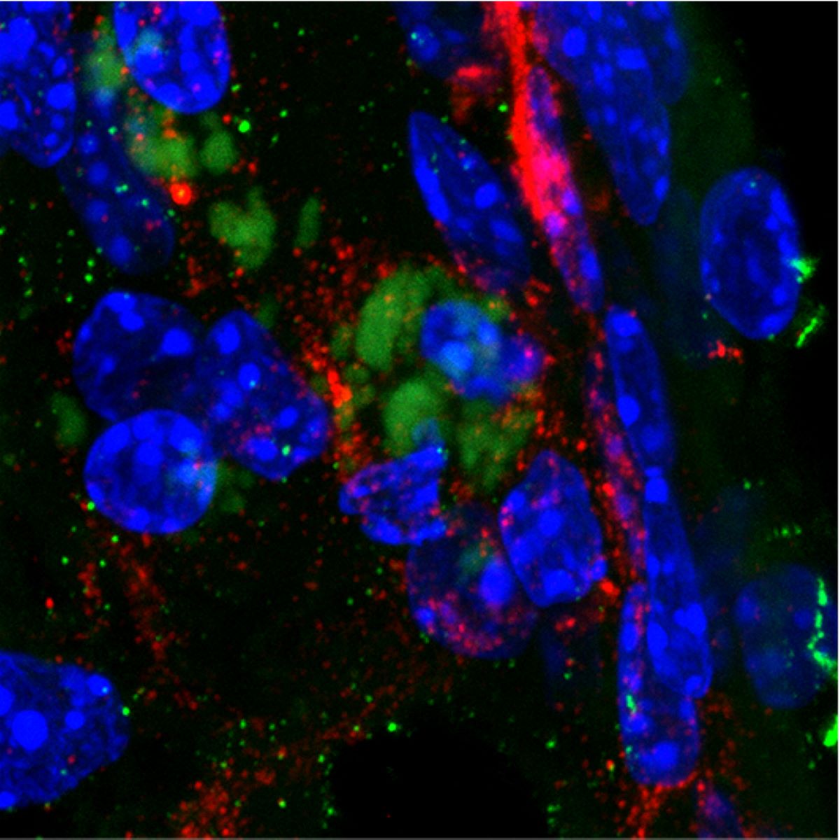 Griffith_Uni's tweet photo. Attention all nose pickers! New research suggests picking your nose could increase the risk for Alzheimer's and dementia as bacteria can travel through the olfactory nerve in the nose and into the brain.

https://t.co/z9oRAiaXhy https://t.co/OYFijlZ8xN