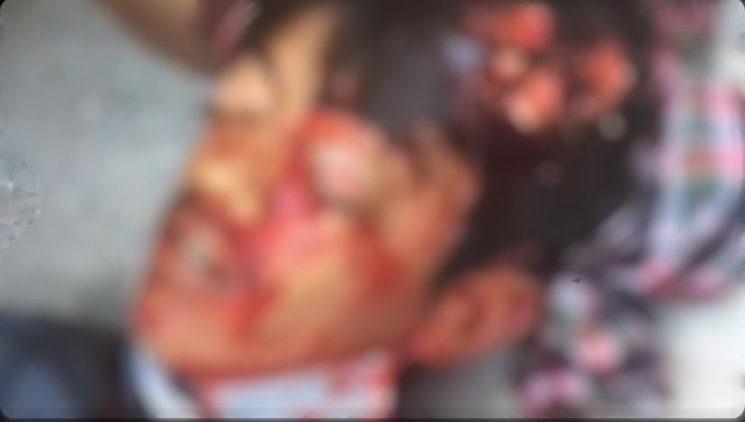 farzinkadkhodae's tweet photo. هشدار:تصویر دلخراش
کودکی که دقایقی پیش در منطقه کوثر زاهدان با شلیک مستقیم به ناحیه سر کشتند.
تا این لحظه دستکم ۶ نفر در اعتراضات زاهدان کشته شده‌اند.
#مهسا_امینی 
#زاهدان https://t.co/FvQ5ngb6fK