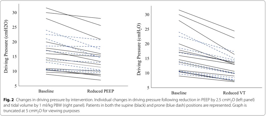 mandres80's tweet photo. Paradoxical response to chest wall loading predicts a favorable mechanical response to reduction in tidal volume or PEEP https://t.co/Fqe8YhDxZn @crdc2001 @Dr_G_Ortiz @ucisantaclara @AMCI_Colombia https://t.co/ChA1ZWmjhS