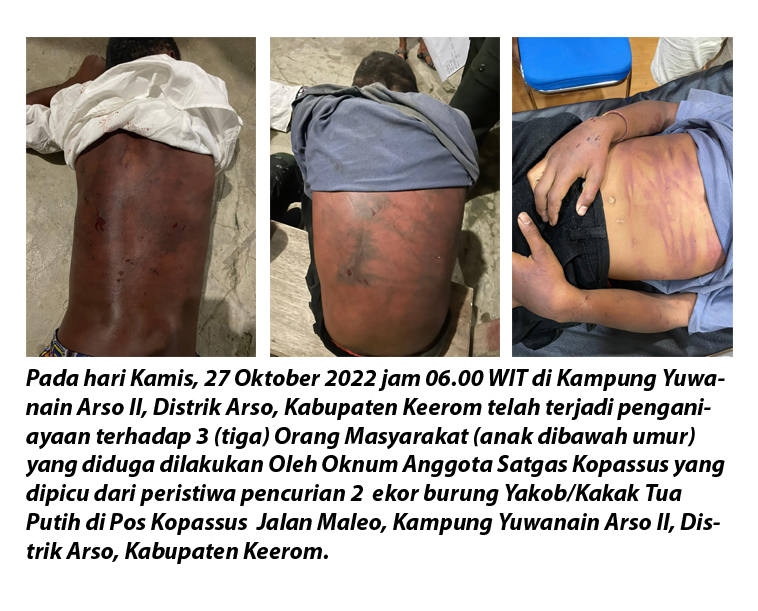 VictorcMambor's tweet photo. Makanya OAP ini sulit percaya sama negara Indonesia ini karena banyak aparat keamanannya yg beroperasi di Papua, kelakuannya biadab seperti ini. Menyiksa anak2. 
#Papua #Indonesia #PapuanLivesMatter @KPAI_official https://t.co/chISrSDVHI