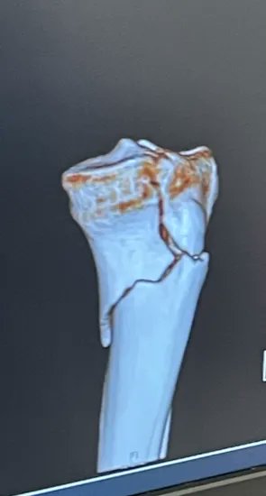 Summit Physio tweet media