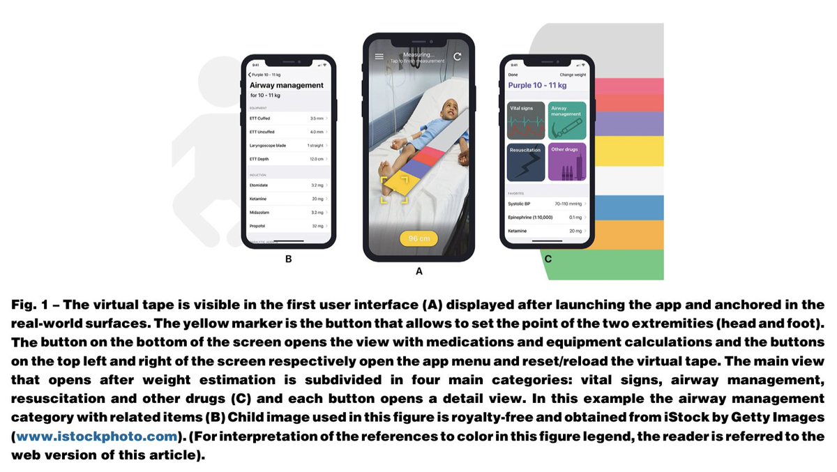 The article cited an AR-assisted smartphone app to estimate the body weight in critically ill children developed by our team @tscquizzato @giovannilandoni @carenzmd @azangrillo resuscitationjournal.com/article/S0300-…