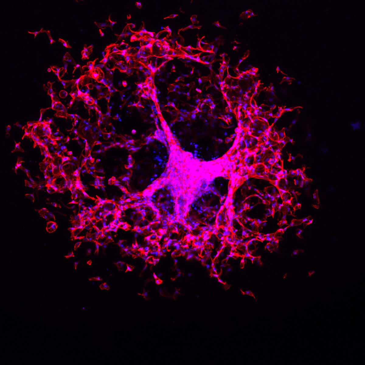 Ovarian cancer cells in our engineered hydrogels for my #fluorescencefriday #CancerResearch