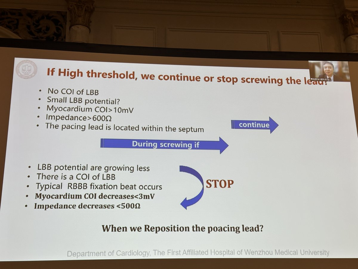 Edward J Schloss MD (@ejsmd) on Twitter photo .<a href="/MdHuang/">Weijian Huang</a> --
When to stop screwing in LBBA lead --
✳️ LBB potential decreases
✳️ Myocardial COI decreases < 5 mV
✳️ Impedance falls < 500 Ohm
#PPS6 .<a href="/MdHuang/">Weijian Huang</a> --
When to stop screwing in LBBA lead --
✳️ LBB potential decreases
✳️ Myocardial COI decreases < 5 mV
✳️ Impedance falls < 500 Ohm
#PPS6