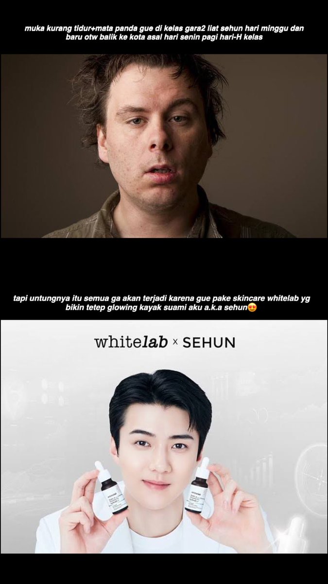 binvinzie's tweet photo. @whitelab_id Aku rela pergi bdg-jkt pdhl bsk senin ada kelas dosen killer, jd begitu nyampe lgsg kelas, tp demi dapetin Golden Ticket utk meet&amp;greet sama Sehun apa si yg engga😍 kl kata sound tiktok sih “do anything for u, sacrifice my life to be ur wife”🤪🫶🏻 #WhitelabXSehun #ScientistGanteng https://t.co/cb616dwJXy