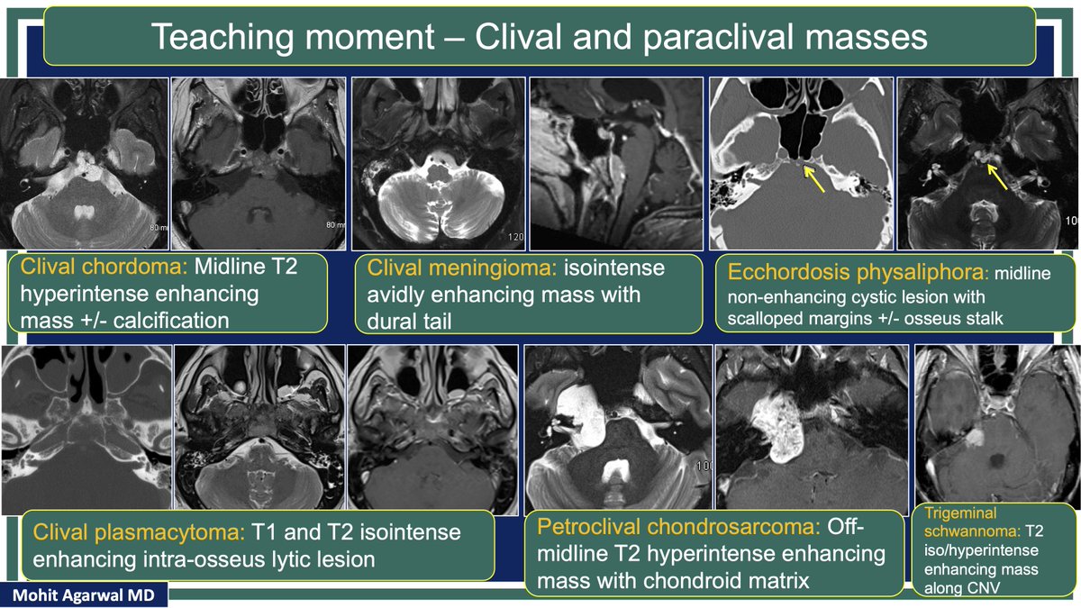 MohitAgNeurorad tweet picture