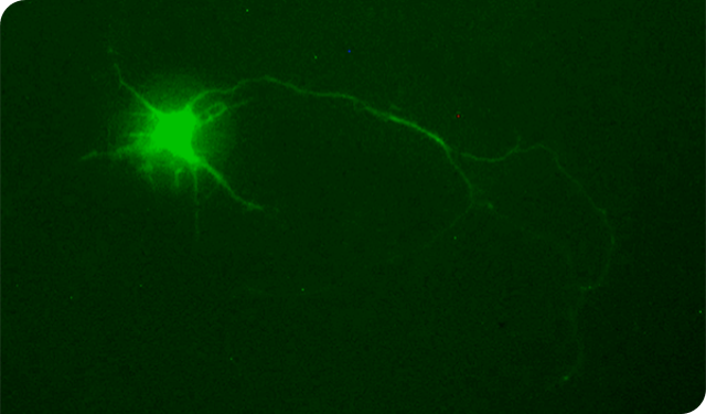 cytosurge's tweet photo. Stimulate, inject into, and analyse #single neurons.
 
#FluidFM technology allows for gentle and controlled #singlecell manipulation, ideal for #neuroscience research.

Learn more here 👉https://t.co/BjqFFkUeII https://t.co/aztIDJwBKM