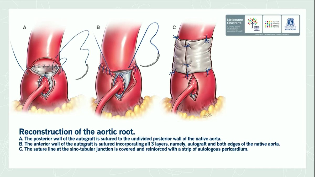 AATS Journals tweet media