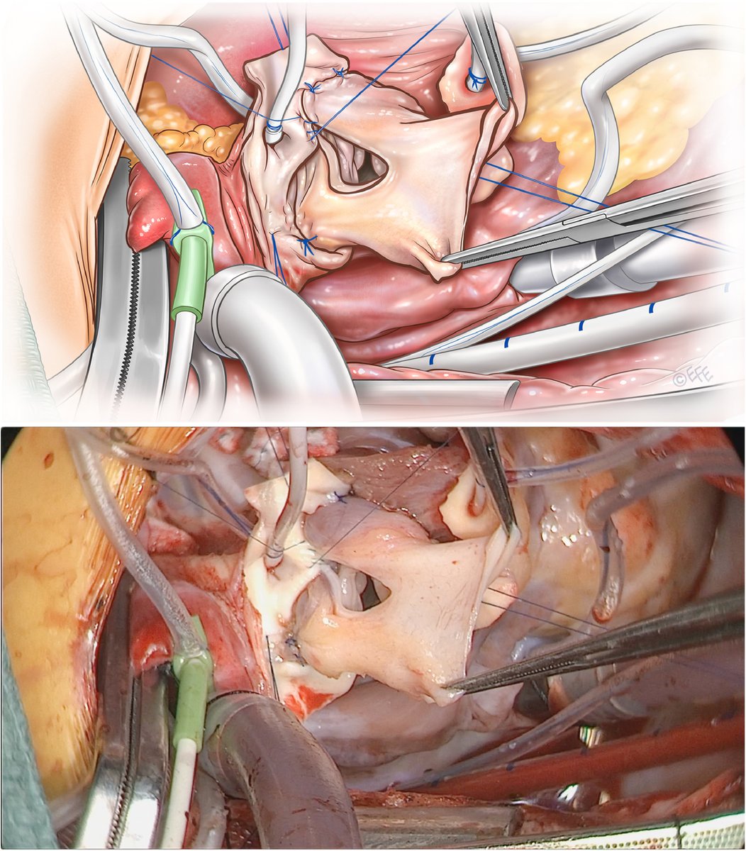 AATS Journals tweet media
