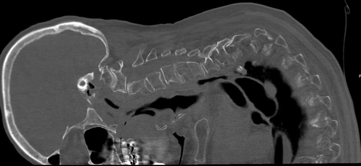 Dan Wyler, M.D. tweet media