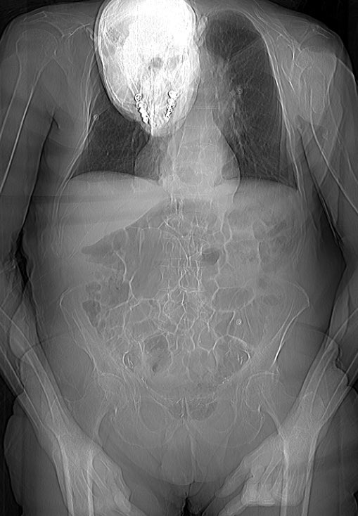 Dan Wyler, M.D. tweet media