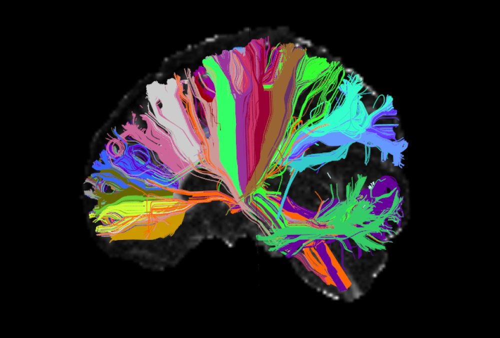Elystrust's tweet photo. Thanks to @psusanjackson for the share. "Mental illness is not in your head - Decades of biological research haven’t improved diagnosis or treatment. We should look to society, not to the brain."  More: https://t.co/VsaSjCVI1G #elysian #mentalhealth #science #selfcare https://t.co/7sSBgJpGz7