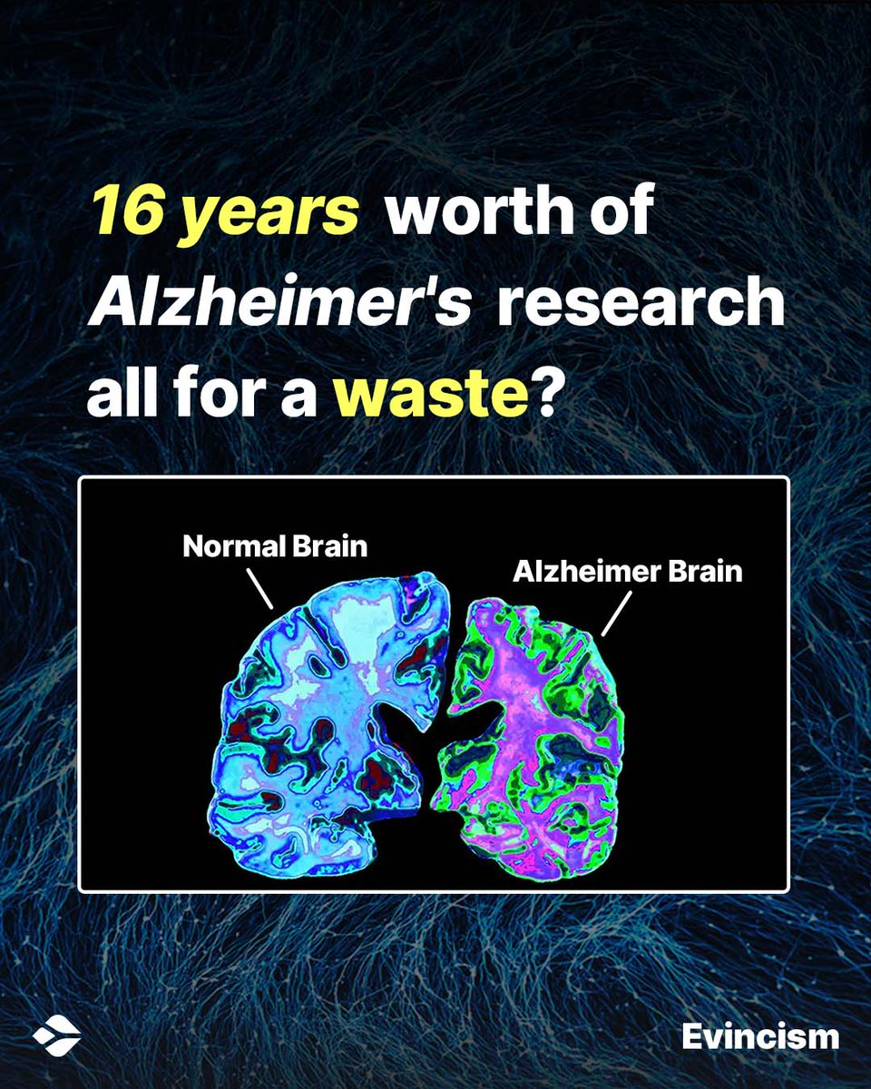 1/5
There is a massive question mark on 16 years worth of research on the amyloid beta hypothesis for Alzheimer's disease. 

The amyloid hypothesis states that specific beta proteins present in the brain cause Alzheimer's.
#science #NeurologyEd