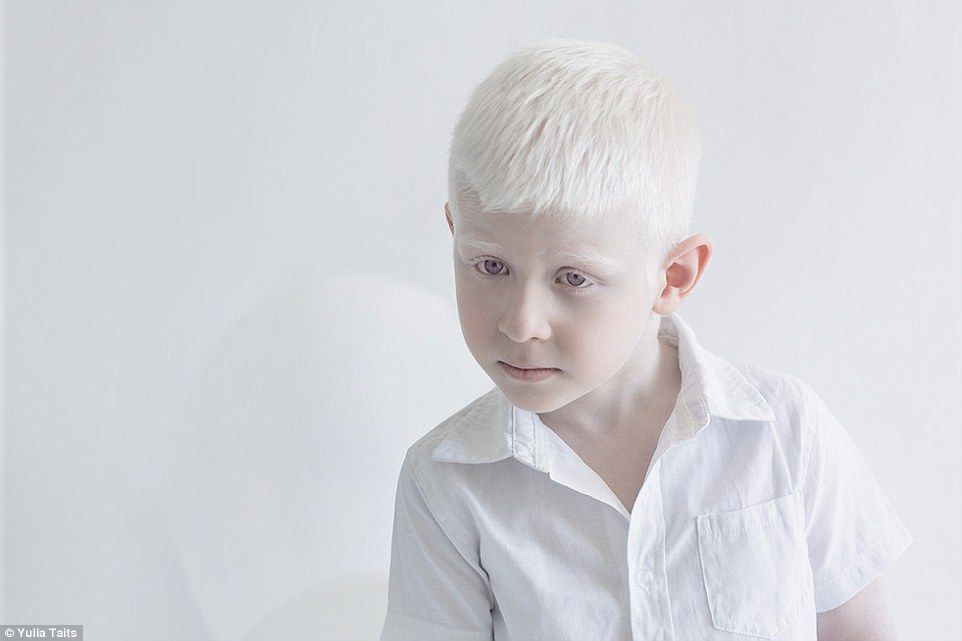 El projecte fotogràfic de la Yulia Tates, Porcelain beauty, es basa en persones albines: 'Their unique beauty hipnotizes me. This beauty is so pure and amazing for me, as if it was taken from fantasies and fairy tale legends'