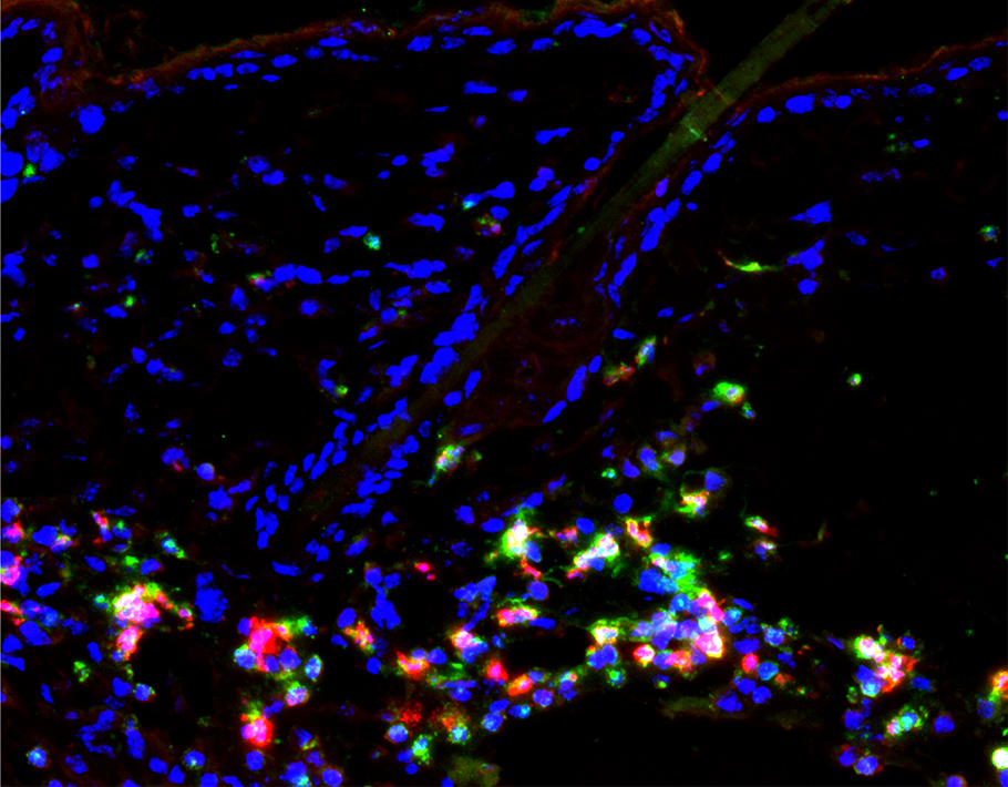 SciImmunology's tweet photo. A new study in mice finds that colonization with S. aureus on the skin worsens systemic lupus erythematosus (SLE) by affecting #neutrophil behavior. @TohokuUniPR

Read more: https://t.co/FI8laHtArd https://t.co/BFaKCkTATw