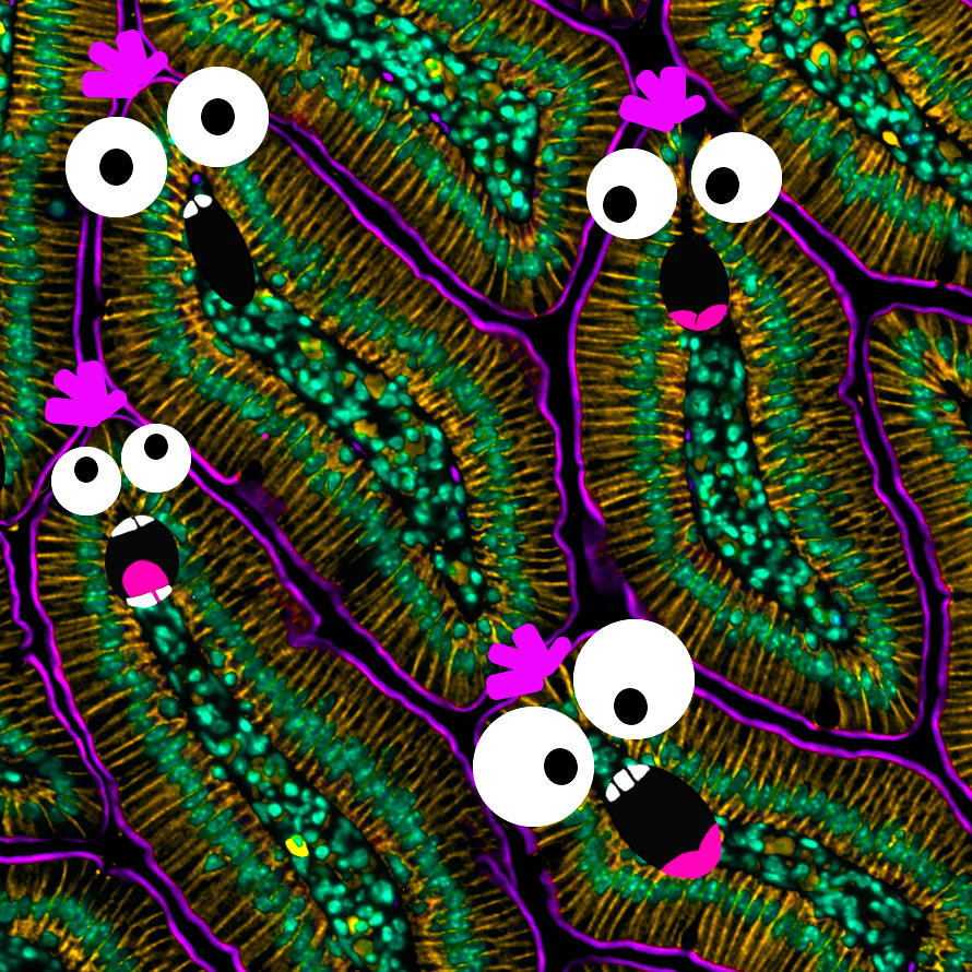 How is October almost over? 

#MicrosCreepy #FluorescenceFriday #intestine #microscopy