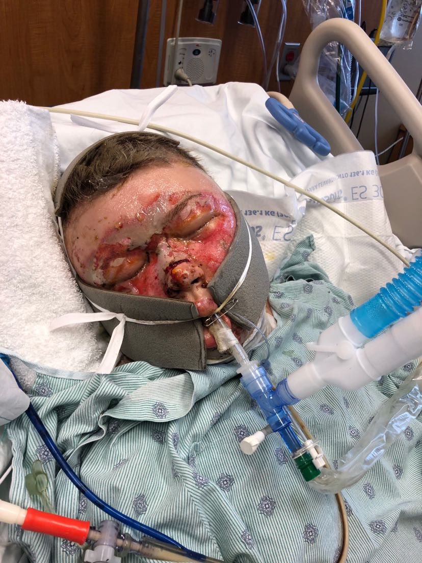 kylie_benson_'s tweet photo. 3 years ago, today I crawled out of a burning vehicle, walked away while engulfed in flames, then lived to tell about it. Pretty crazy honestly 😎🔥 https://t.co/9hM8lL5xGB