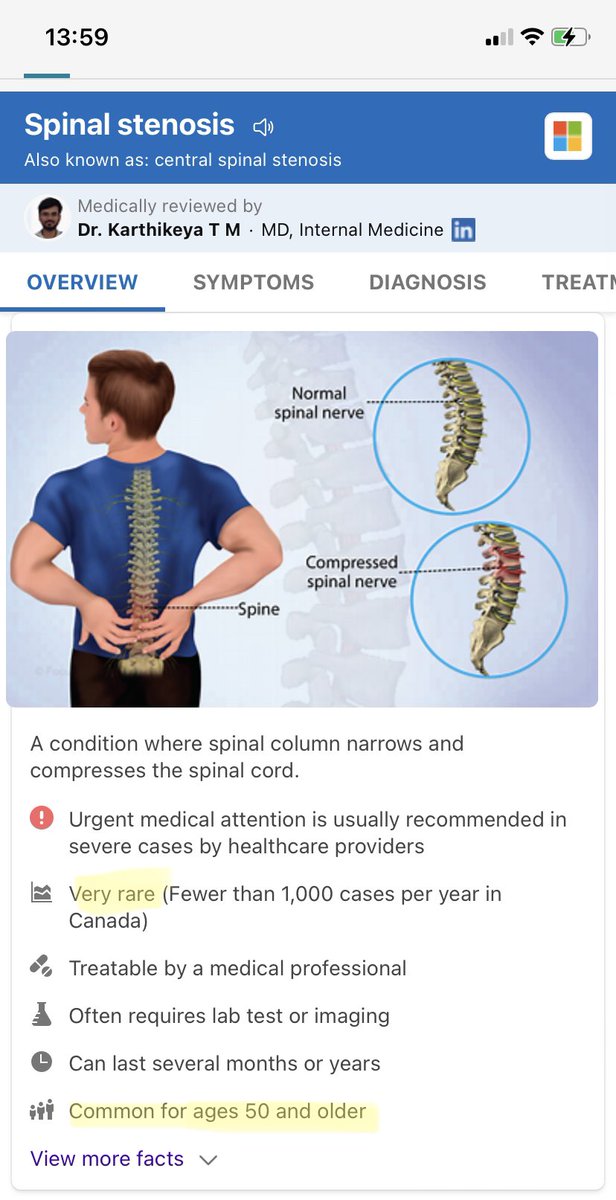 mybackh0rts's tweet image. what the hell man i just found out i’ve got a rare medical condition