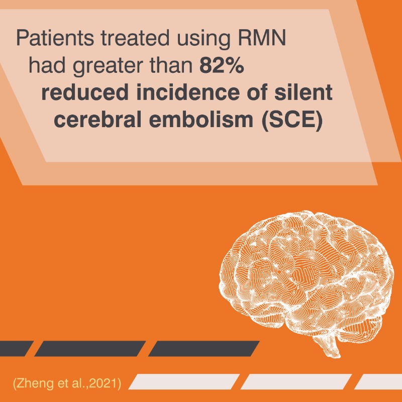 Stereotaxis's tweet photo. Do Silent Strokes Matter?🧠⚡
Embolic strokes are among the most harmful periprocedural complications of #AFib ablation. Check out this paper in @FrontiersIn #CardiovascularMedicine describing fewer SCEs with #RoboticEP
#WorldStrokeDay #EPeeps #Afibablation