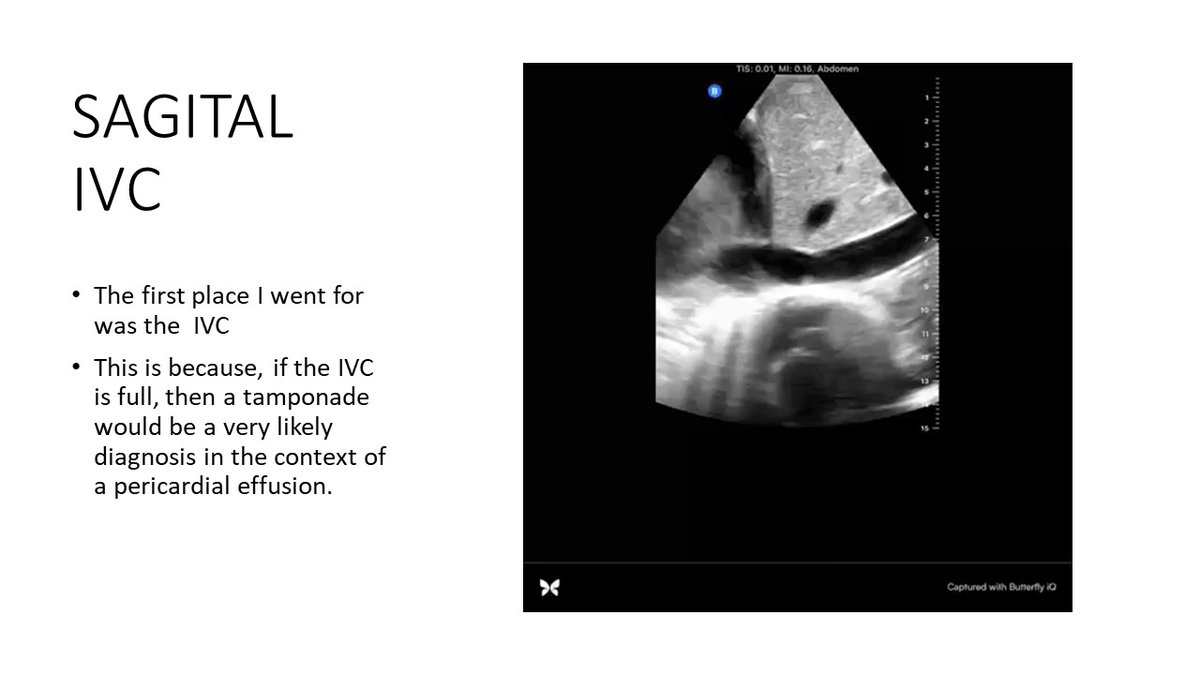 WINFOCUS's tweet image. #WINFOCUS22 (winfocusworldcongress.com/registration/) World #POCUS Congress will host WORLD EXPERTS; sneak-peak of lecture(re)s; 
Dr Papa Mbroh: "MY PRACTICE: How PoCUS narrows diagnosis, accelerates decision making and decreases patient cost", 3DEC@10:00