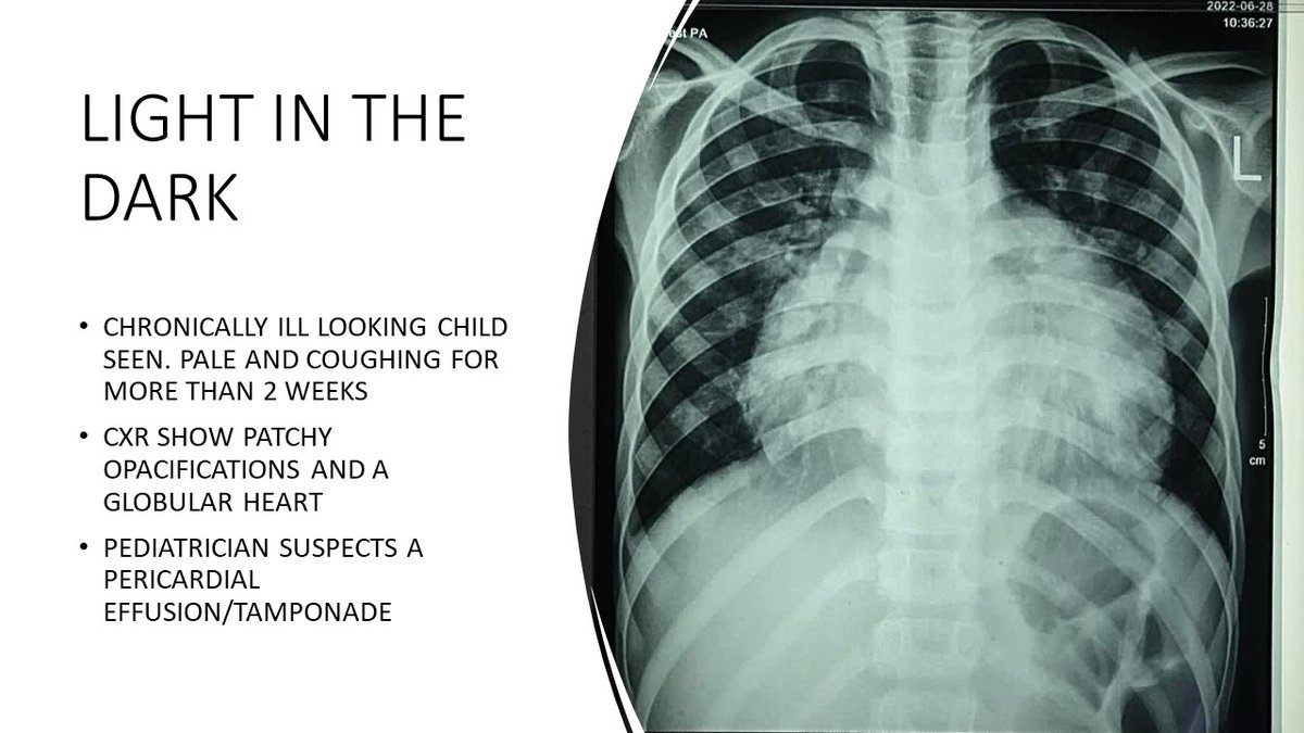 WINFOCUS's tweet image. #WINFOCUS22 (winfocusworldcongress.com/registration/) World #POCUS Congress will host WORLD EXPERTS; sneak-peak of lecture(re)s; 
Dr Papa Mbroh: "MY PRACTICE: How PoCUS narrows diagnosis, accelerates decision making and decreases patient cost", 3DEC@10:00