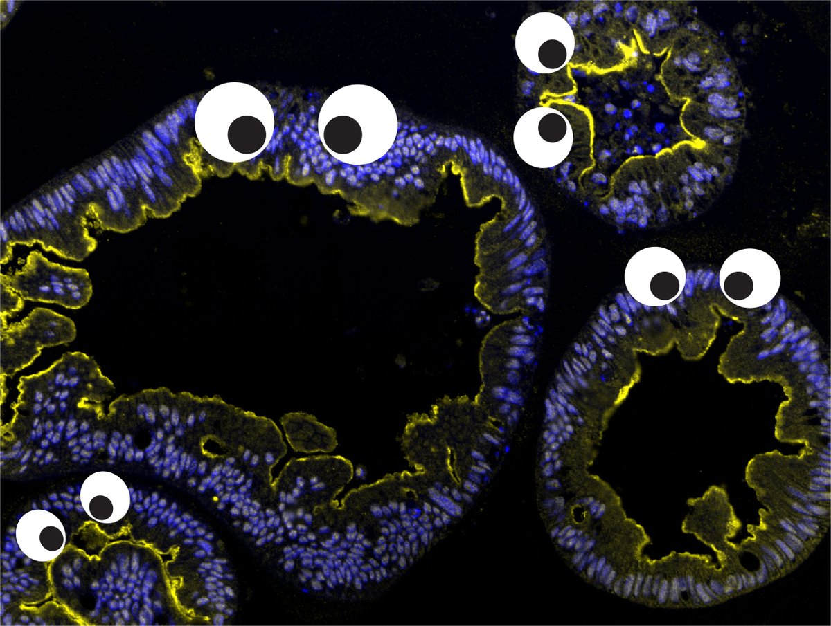 Happy #FluorescenceFriday! I'm going to miss #microscreepy posts & all the googly eyes when October is over

#sciart #googlyeyes #spooktober #bioart #organoids #fluorescentfriday