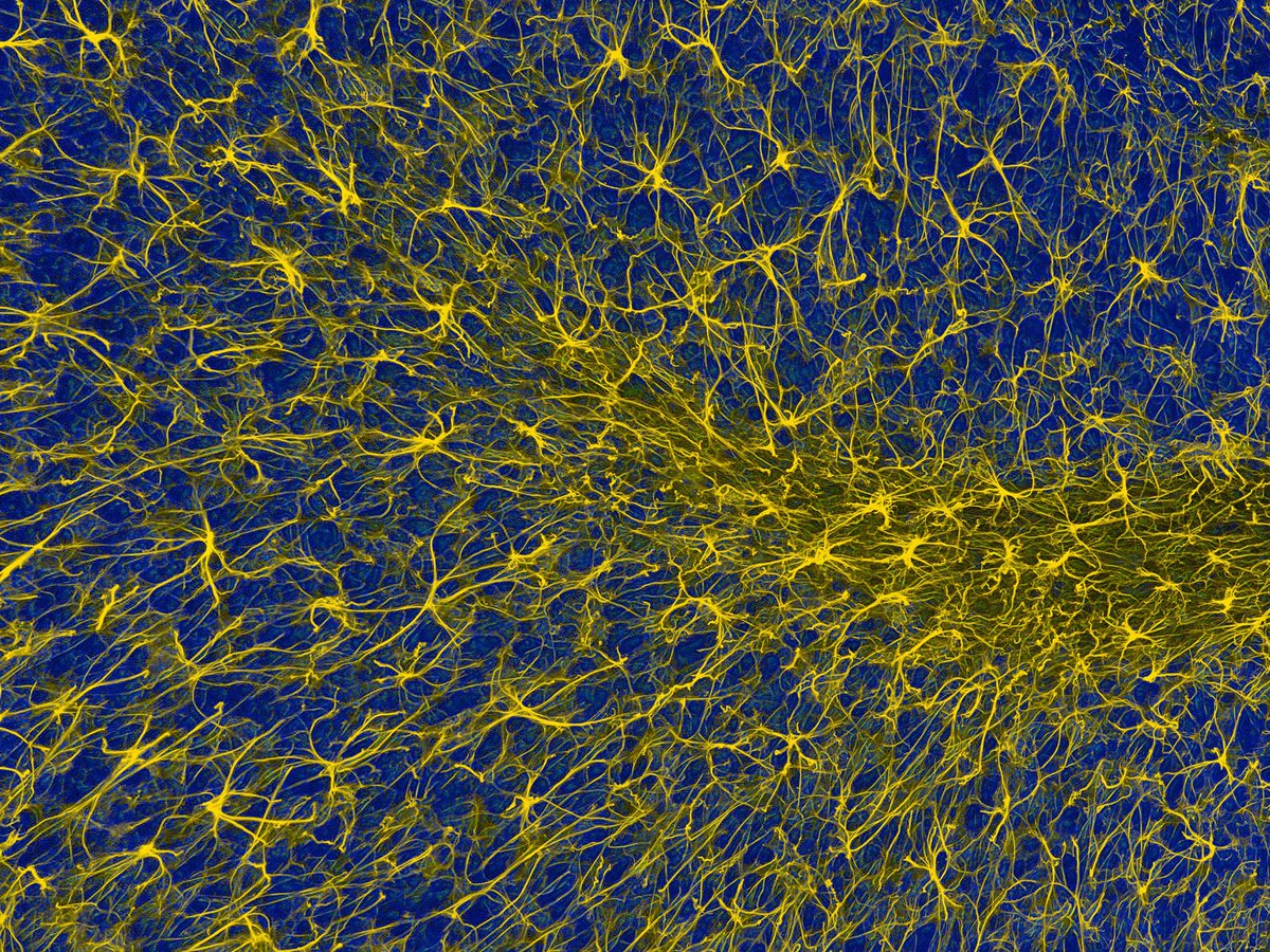 2-Photon fluorescence image of glial cells in the cerebellum. Source: Thomas J. Deerinck #neuroscience #neurotwitter