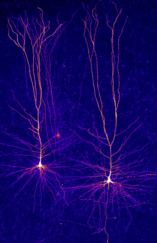 Neurons in layer 2/3 of the human neocortex. Credit: Humboldt University of Berlin #neuroscience #neurotwitter