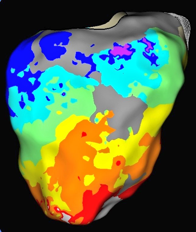 Josh Shriver tweet media