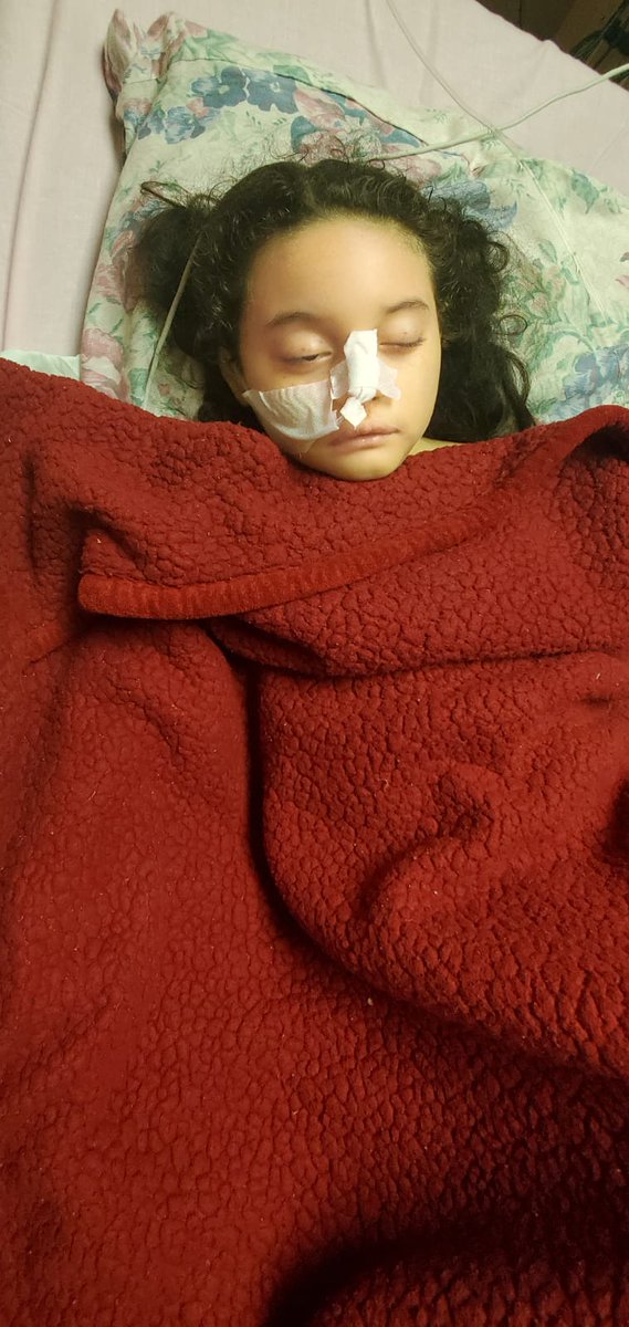 BenjiAnariba's tweet photo. Así cómo hacen viral tonterías de Play Land Park y otras cosas, ayúdenme a hacer viral esto, Emily es una bebe de 6 años que urge un trasplante de Médula, ya no hay tiempo y cada día es vital, AYUDEMOS PORFA 🥺 @DrDark_Angel @gabbioviedo @SalvaPresidente @LOKOXMOTAGUA @IsabelTVC https://t.co/YubjM2e3i7