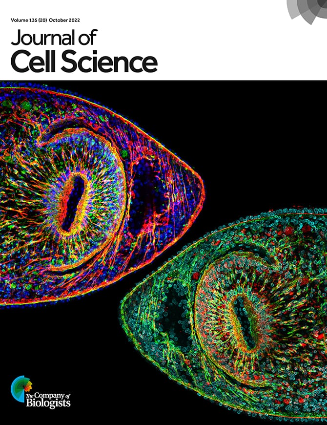 Palakodeti Lab (@palakodeti_lab) on Twitter photo We are on the cover, folks! Cheers 🎉😃
Shown here are planarian transverse sections around the pharynx stained for collagen4, muscle fibers, & dapi.
CC: <a href="/DBT_inStem/">iBRIC-inStem</a> <a href="/J_Cell_Sci/">J Cell Science</a> <a href="/Co_Biologists/">The Company of Biologists</a> <a href="/DPalakodeti/">Dasaradhi Palakodeti</a> <a href="/Vinay_k_Dubey/">Vinay Kumar Dubey</a> <a href="/SouradeepSarkar/">Souradeep | সৌরদীপ</a> <a href="/VairavanL/">Vairavan Lakshmanan</a> @RimpleDalmeida We are on the cover, folks! Cheers 🎉😃
Shown here are planarian transverse sections around the pharynx stained for collagen4, muscle fibers, & dapi.
CC: <a href="/DBT_inStem/">iBRIC-inStem</a> <a href="/J_Cell_Sci/">J Cell Science</a> <a href="/Co_Biologists/">The Company of Biologists</a> <a href="/DPalakodeti/">Dasaradhi Palakodeti</a> <a href="/Vinay_k_Dubey/">Vinay Kumar Dubey</a> <a href="/SouradeepSarkar/">Souradeep | সৌরদীপ</a> <a href="/VairavanL/">Vairavan Lakshmanan</a> @RimpleDalmeida