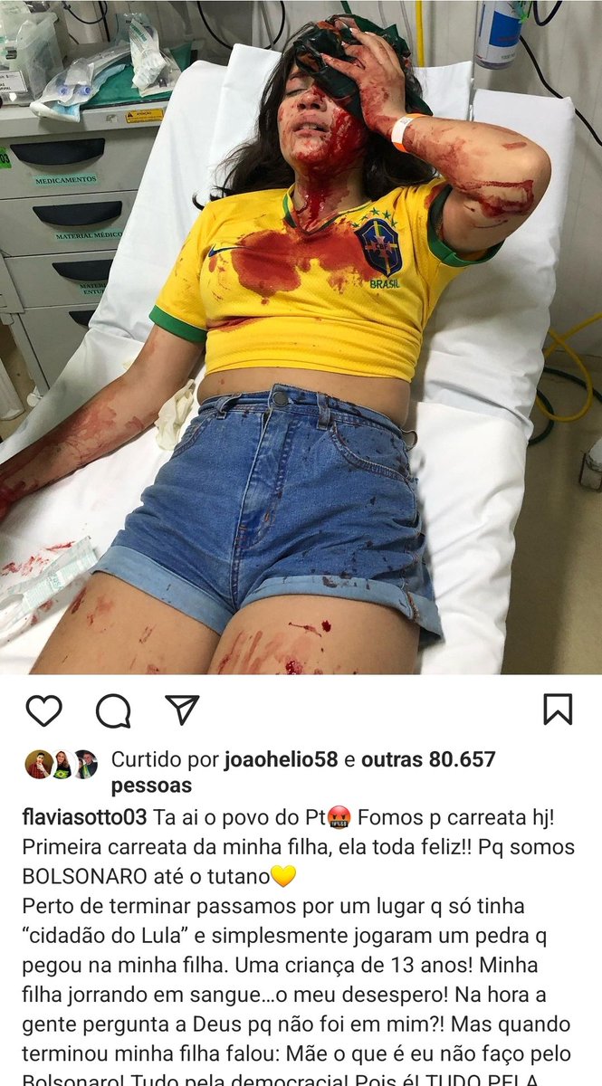 Essa é galera do paz e amor. 

Passaram a noite me ameaçando por telefone e olha o que fizeram com uma garota de 13 anos....

Que Deus a cure prontamente.