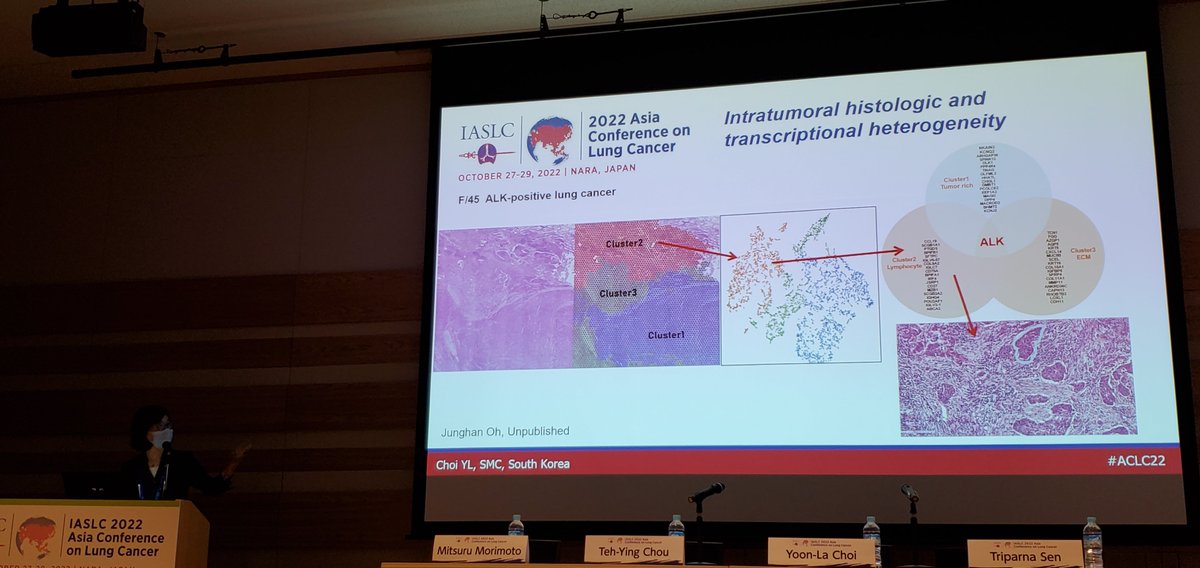 HHorinouchi's tweet photo. Dr. Yoon-La Choi discusses tumor heterogeneity, transformation, and EMT as resistant mechanisms from a pathologist's point of view. #ACLC22 @IASLC #LCSM https://t.co/6s2wSRrsfo