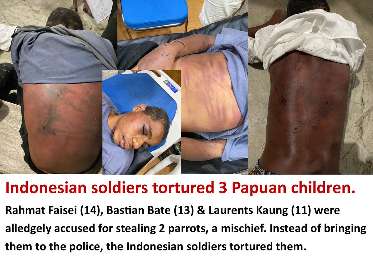 Oridek's tweet photo. Source: https://t.co/HHLLteMpyo
#G20ShameOnYou #Indonesia #OHCHR_VisitWestPapua https://t.co/m1HcvYV6YT
