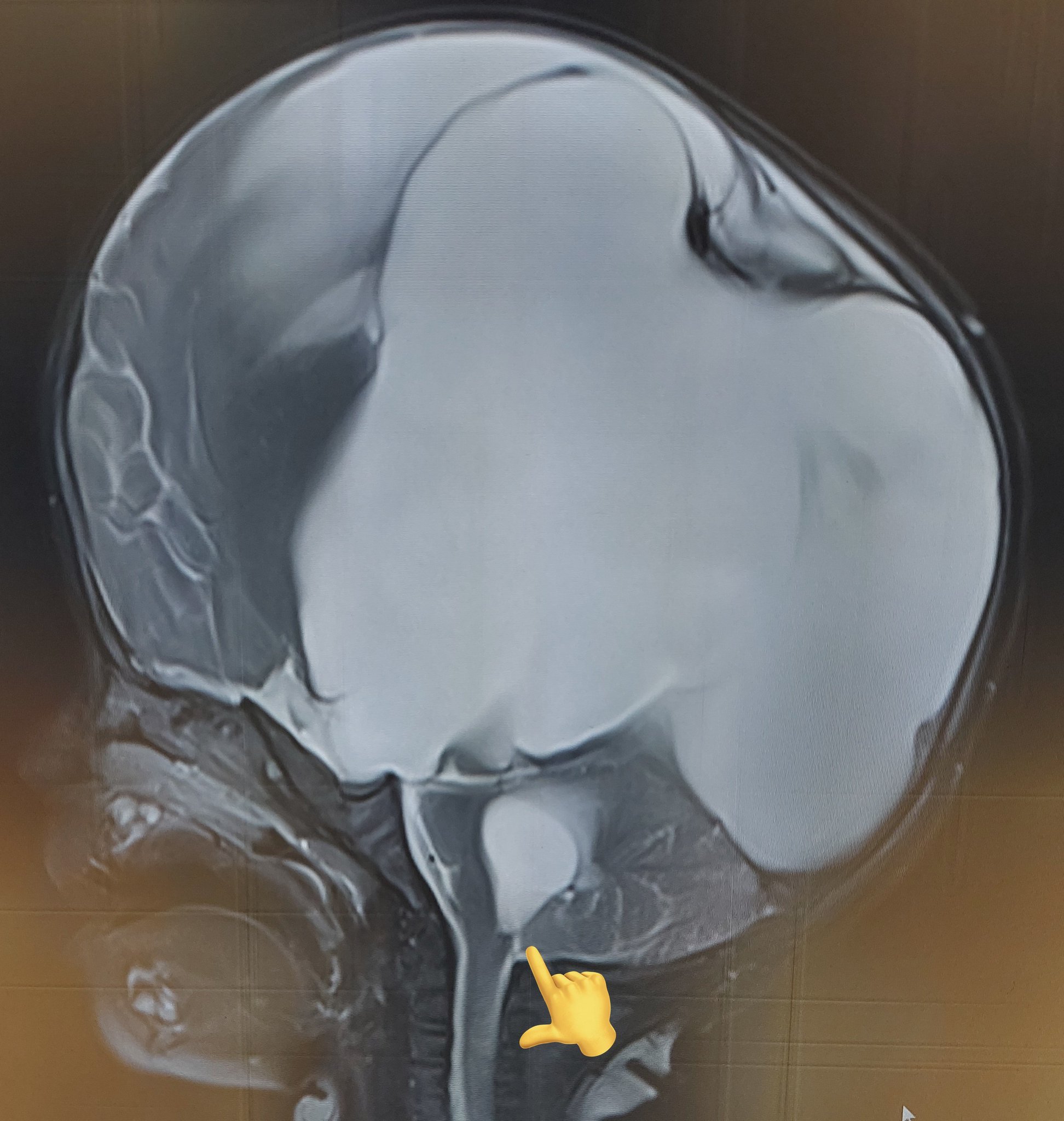 Rajesh S on Twitter "9 month old kid with enlarging head size🙇‍♂️ ☣