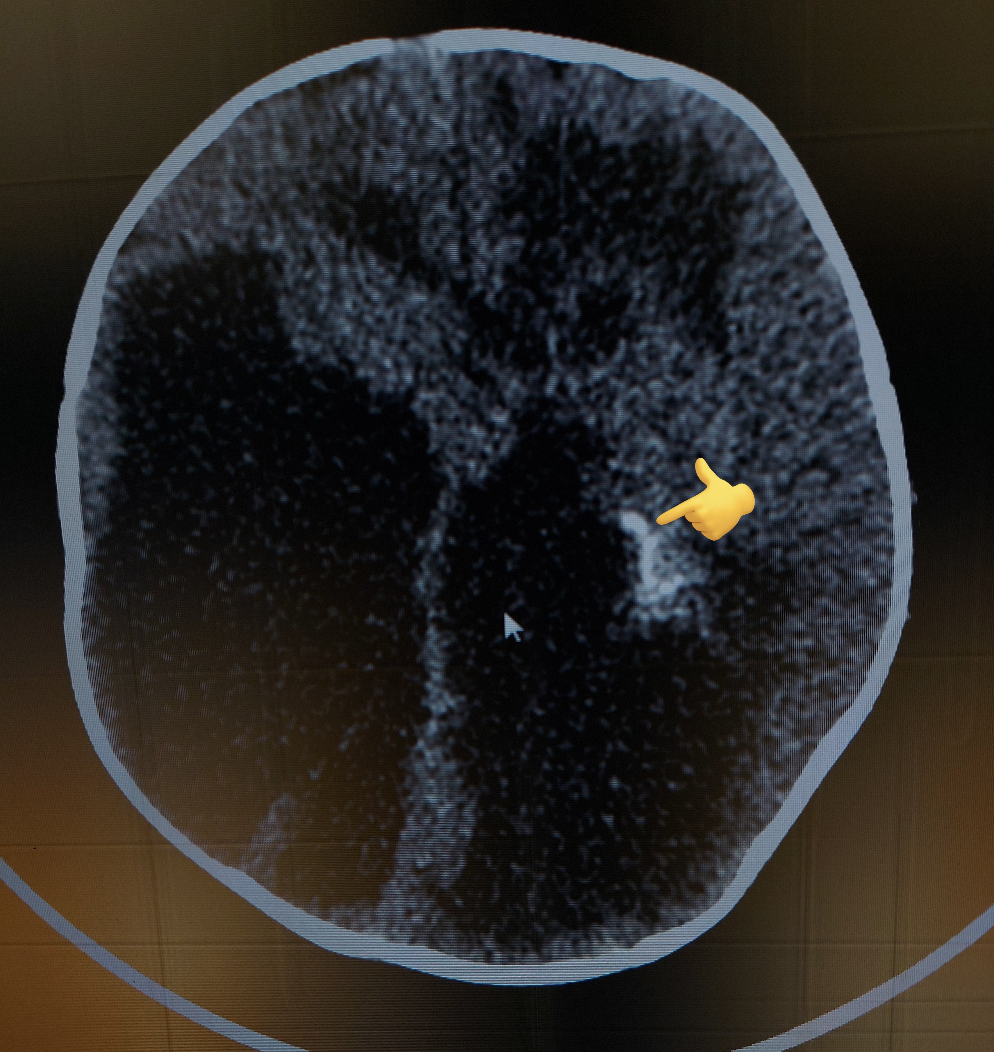 Rajesh S on Twitter "9 month old kid with enlarging head size🙇‍♂️ ☣