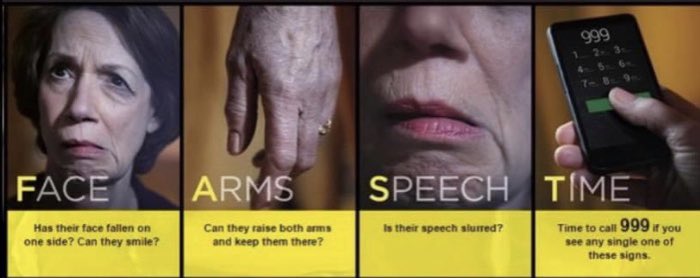 Christine Somerville (@christinesomer1) on Twitter photo On World stroke day take time to recognise the symptoms and remember it can happen at any age. Always call 999! On World stroke day take time to recognise the symptoms and remember it can happen at any age. Always call 999!