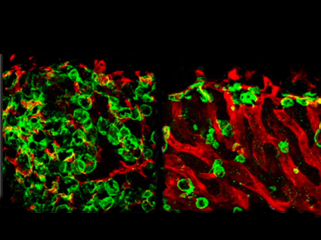 BPoD_s's tweet photo. Role of #oestrogen on blood vessels of bones underlies #osteoporosis risk with #menopause. Image and research by Julia Rodrigues et al @Ramasamylab @MRC_LMS in @NatureCVR. Read more on https://t.co/M5IinLI3I2 with @MRC_LMS and @sophtalkssci https://t.co/J0Gjw241i8