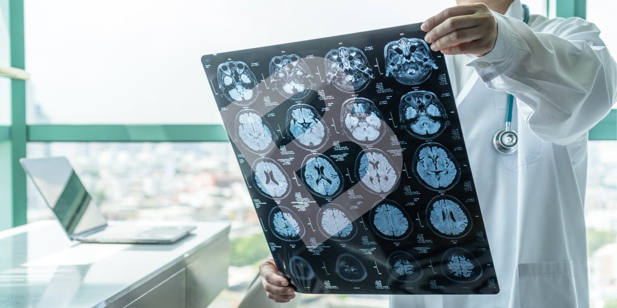 Mit dem #WeltSchlaganfallTag soll das Thema #Schlaganfall ins öffentliche Bewusstsein gerückt und aufgeklärt werden. Ein gesunder Lebensstil kann das Schlaganfallrisiko mindern. Im Ernstfall sollte schnell gehandelt und die 112 gewählt werden, denn hier zählt jede Minute!