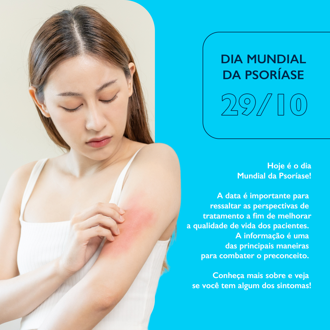 indeovbrasil's tweet photo. Hoje é o dia Mundial da Psoríase!
A data é importante para ressaltar as perspectivas de tratamento a fim de melhorar a qualidade de vida dos pacientes. https://t.co/CVC98jTsFl