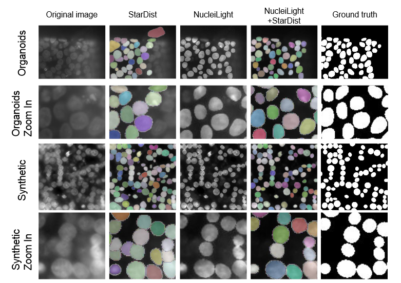 vnzloy's tweet photo. "SalienceNet: an unsupervised Image-to-Image translation method for nuclei saliency enhancement in microscopy images
Emmanuel Bouilhol et al.
bioRxiv. posted 28 October 2022, 10.1101/2022.10.27.514030
https://t.co/lCPcKPSFWj" https://t.co/vzn3dNkLpL