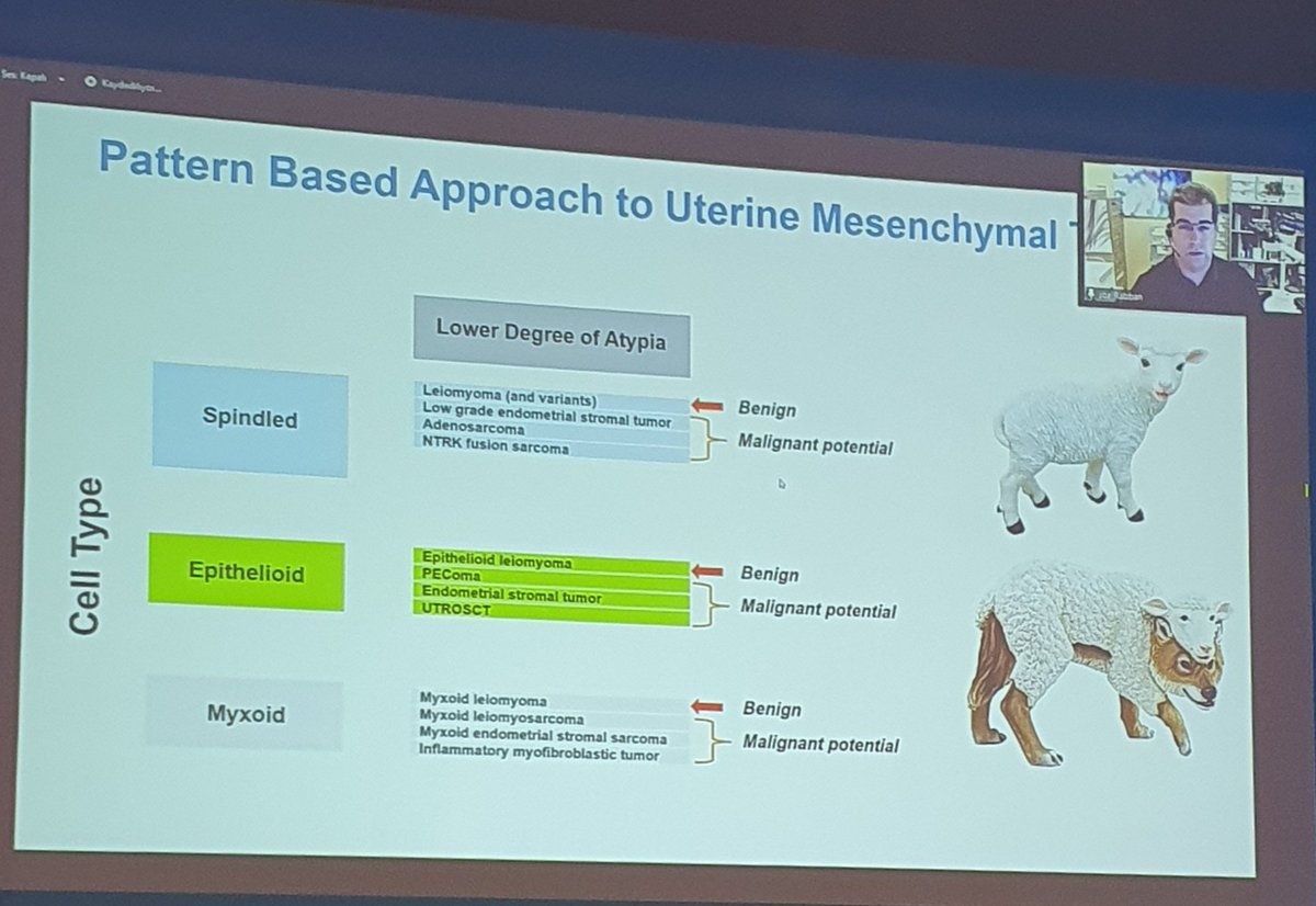 DrSultanClskn's tweet photo. An another excellent and impressive presentation about uterine mesenchymal tumor, by Dr Joseph Rabban 🤩 #gynpath #pathology #TCPİzmir22 #josephrabban #nationalpathologycongress @MehmetKefeli @Usubutun @drbyp2 @FatmaNrksknuygn @dreylulgun @sumeyra_md @seyma_buyucek @glinglerimek https://t.co/CxhFCwtEAG